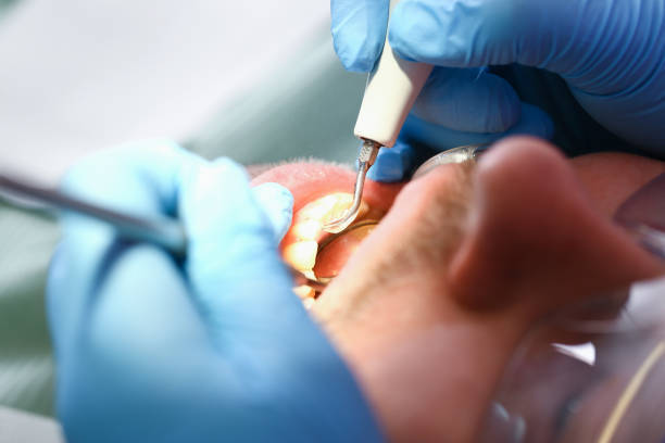 Best Emergency Tooth Extraction  in Heath, OH